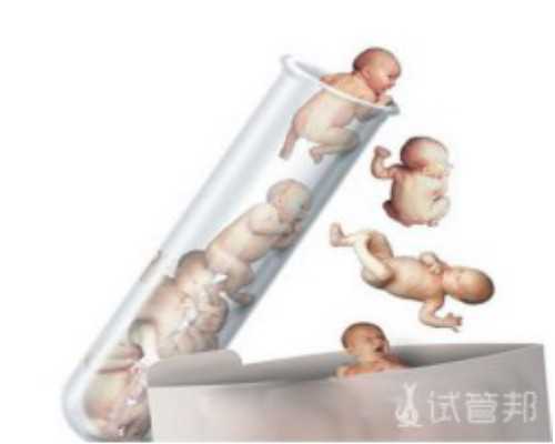 杭州做三代机构,杭州试管婴儿做一次多少钱