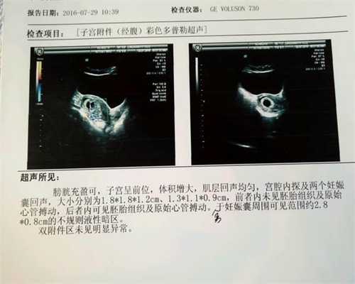 杭州那个医院代孕最好_杭州代孕价位是多少_孕宝国际试管_1626757469675