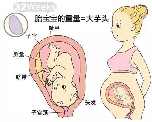 杭州找个代生女要多少钱_哪里有靠谱的供卵试管医院_供卵试管婴儿美中宜和详