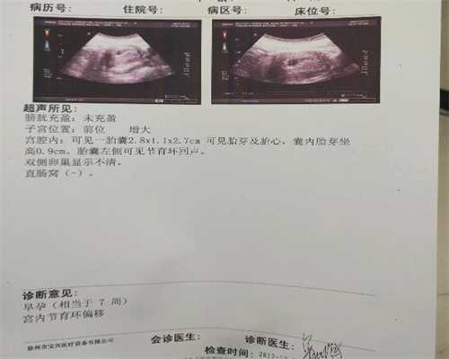 三代生子怎么联系_杭州公立医院做供卵试管_保胎需要打hcg针吗