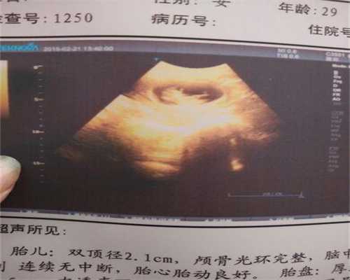 杭州中信湘雅医院有供卵吗_供卵试管和女方血型_LifeLine医院名医篇：妇科生殖