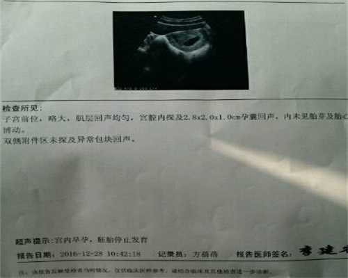 供卵公司_杭州山大生殖医院供卵如何排队_专家谈急性附件炎治疗