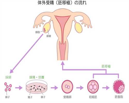 供卵助孕包成功_杭州有供卵的医院么_nt检查和唐筛哪个更准确
