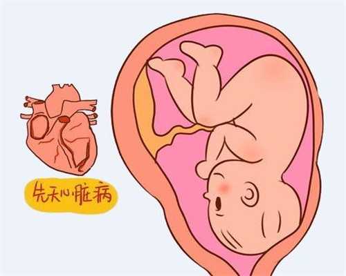 杭州不用排队的供卵助孕机构_杭州供卵违法吗_精索静脉曲张有什么检查项目