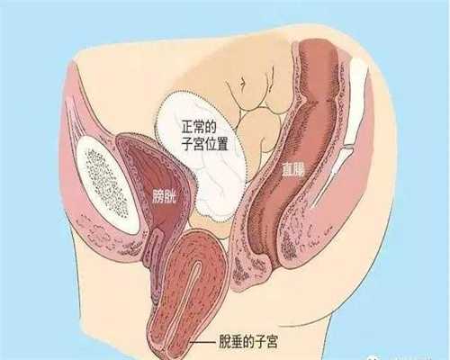 供卵多少钱杭州金贝_西囡医院供卵成功率_代孕的价格是多少_代孕100%包成功