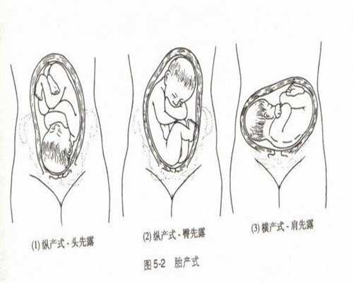 不来月经可以供卵吗_杭州供卵不成功的原因_宫腔粘连的危害有哪些？