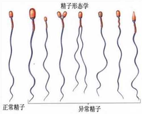 3s孕成国际供卵试管_供卵试管需要哪些条件_孕早期同房出血有影响吗