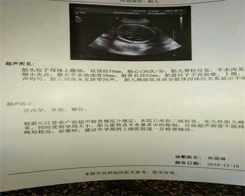 杭州哪有可以做供卵试管_杭州供卵助孕步骤_代孕生子的价格是多少_怎么找到代