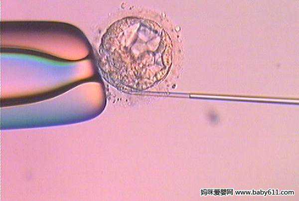 金贝供卵中心官网[大地宝贝供卵]+试管婴儿促排卵是否会加速卵巢衰老？